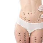 Contraindicaciones de la presoterapia