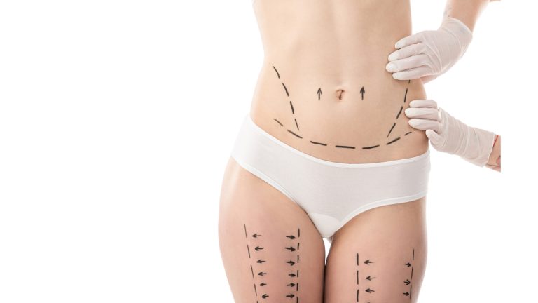 Contraindicaciones de la presoterapia