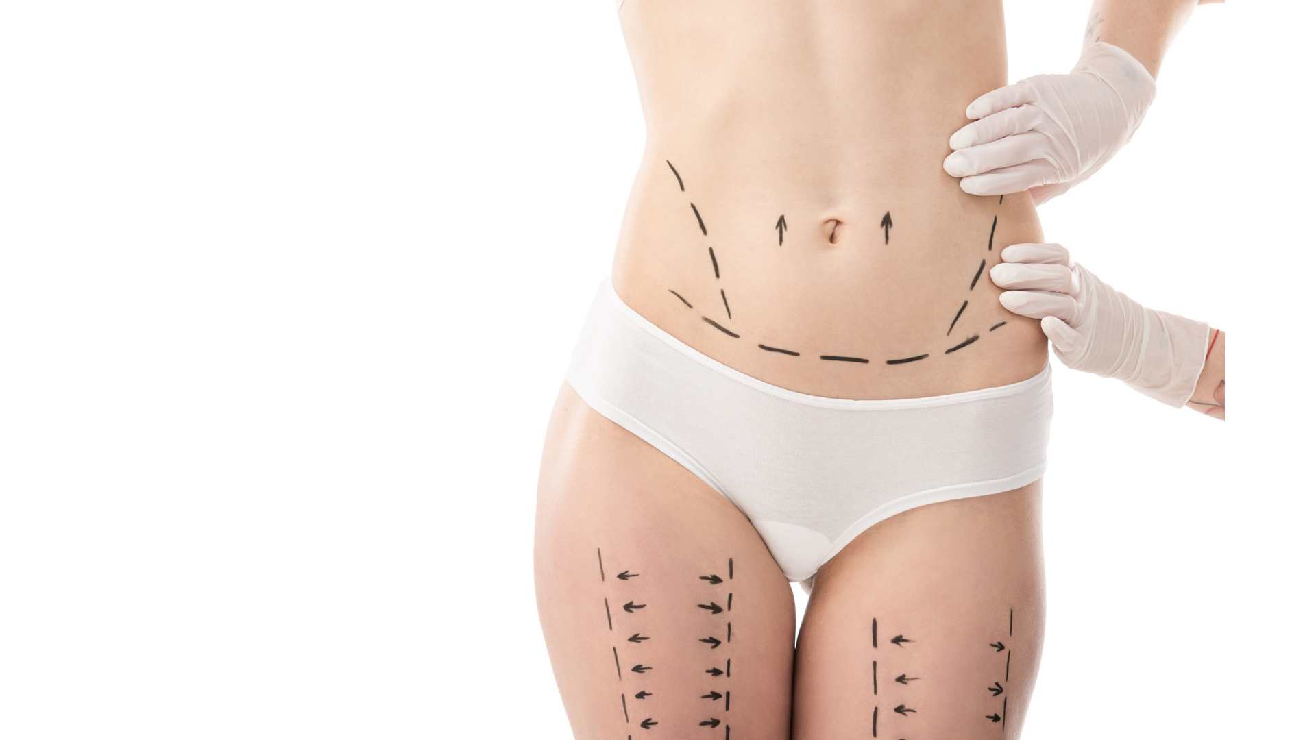 Contraindicaciones de la presoterapia