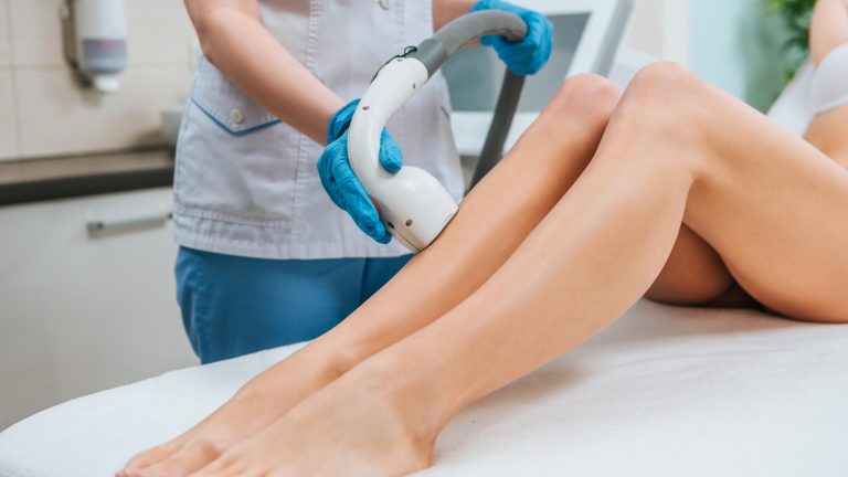 ¿Cuánto dura el efecto del láser de diodo?