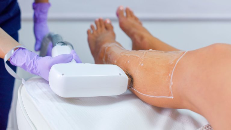 consejos post-tratamiento laser diodo