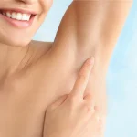 Láser soprano para depilación