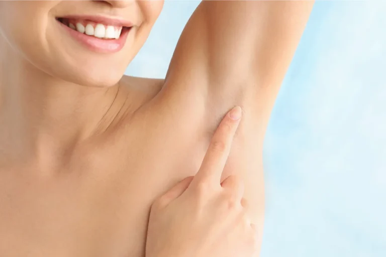 Láser soprano para depilación