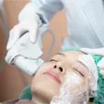 Contraindicaciones HIFU