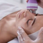 rejuvenecimiento facial