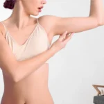 origen de la celulitis