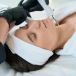 rejuvenecimiento de la piel