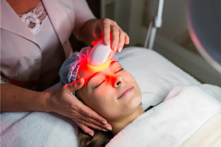 luz pulsada para reducir arrugas