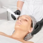 HIFU facial