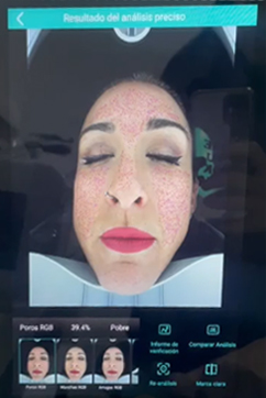 Comprar analizador facial