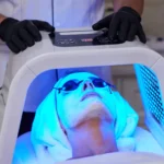 beneficios de la fototerapia