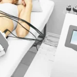 qué es el láser lipolítico