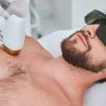 láser de depilación para pieles sensibles