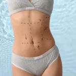 riesgos de la cirugía estética