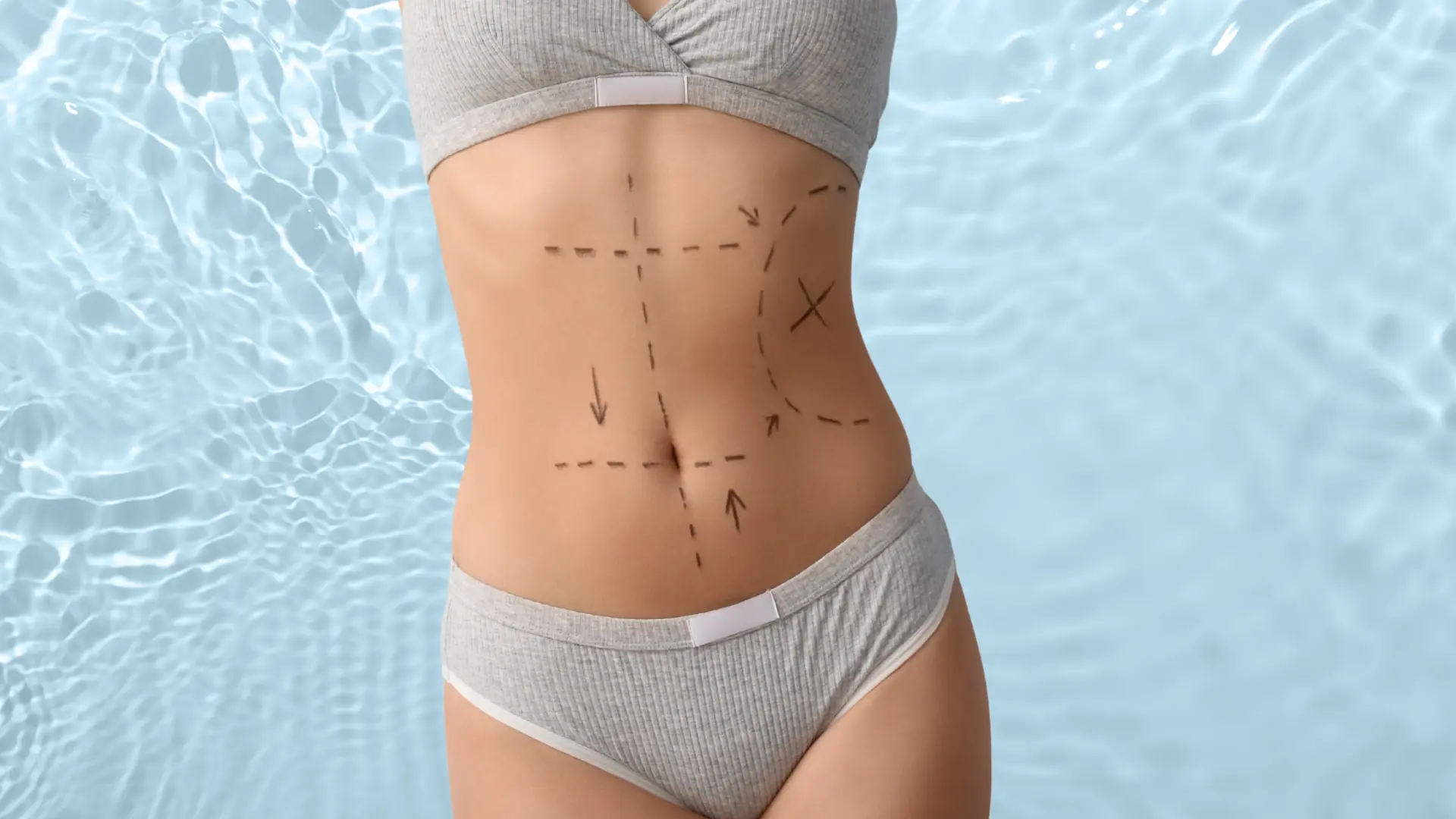 riesgos de la cirugía estética