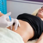 beneficios de la mesoterapia corporal