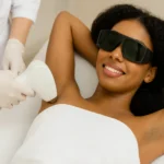 contraindicaciones de la depilación láser